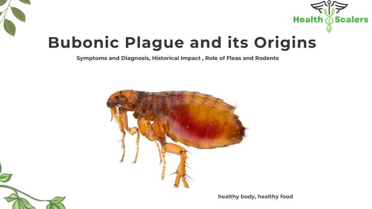 Bubonic Plague and its Origins , Symptoms and Diagnosis, Historical Impact , Role of Fleas and Rodents Bubonic Plague and its Origins